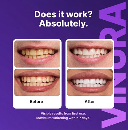 Vinora Purple Whitening Strips